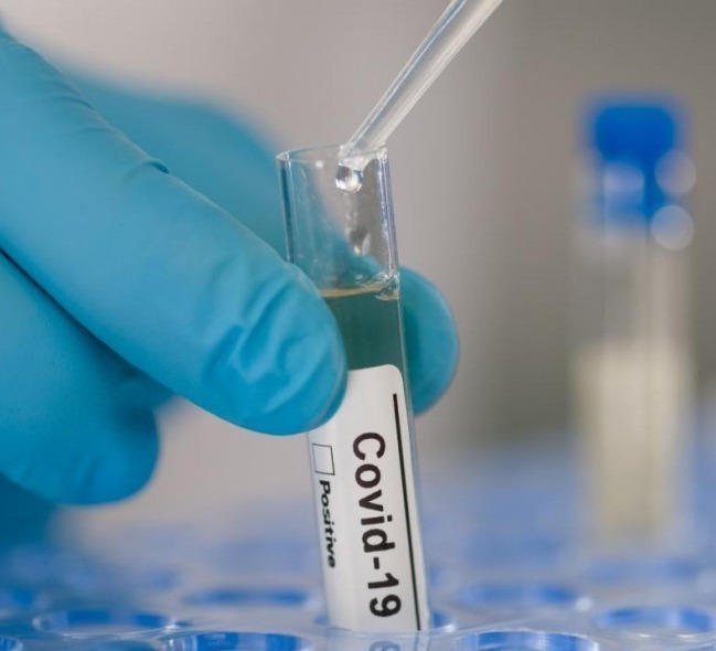 Out of 355 new cases of coronavirus, 176 were detected in Tbilisi