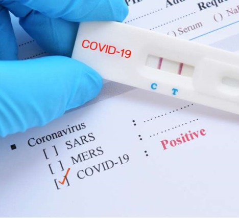 საქართველოში კორონავირუსის 450 ახალი შემთხვევა გამოვლინდა, გამოჯანმრთელდა 254 პირი