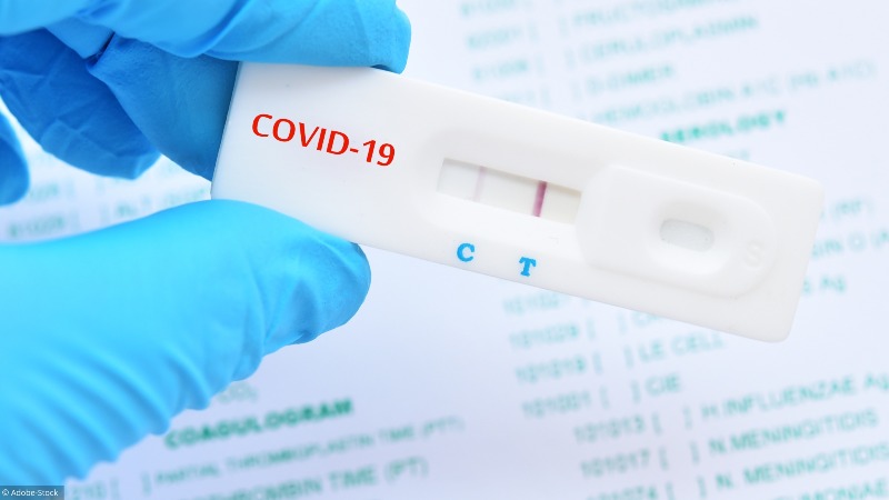 Vaccinated Georgians to be allowed back without negative PCR test paper