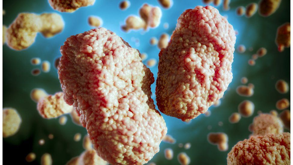 Georgia to receive special PCR tests to detect monkeypox virus in two hours
