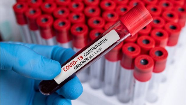 Georgia records more than 1,200 Omicron cases, only 14 hospitalized