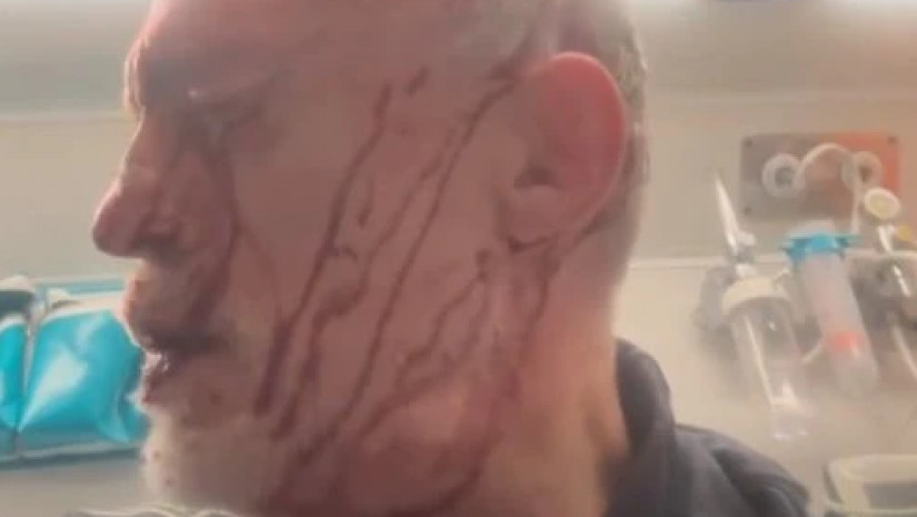 ნადიმ ხმალაძეს საკუთარ სახლთან თავს დაესხნენ